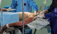 ترمیم پوست سوخته از طریق کشت سلول در دانشگاه علوم پزشکی ایران