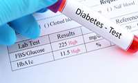 ساری بیشترین شیوع پیش دیابت در کشور را دارد