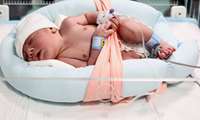 پژوهش تاثیر شیر مادر در زمان افتادن بندناف نوزاد از سوی محقق دانشگاه علوم پزشکی ایران