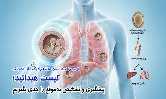 کیست هیداتید؛ از پیشگیری تا درمان 